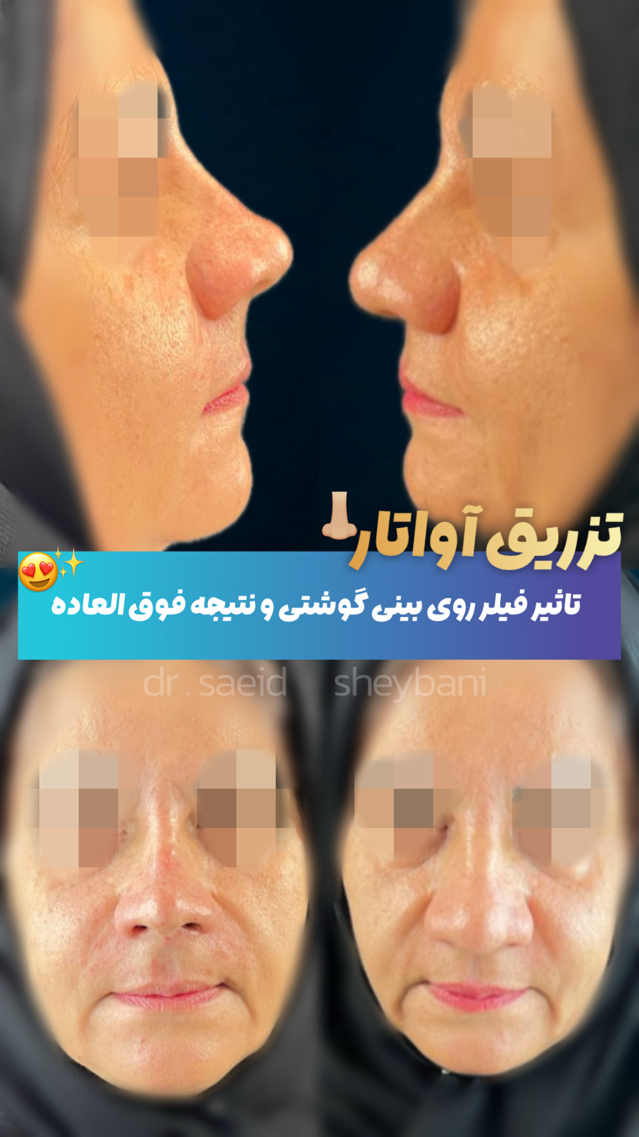 گالری آواتار بینی - تصویر 21