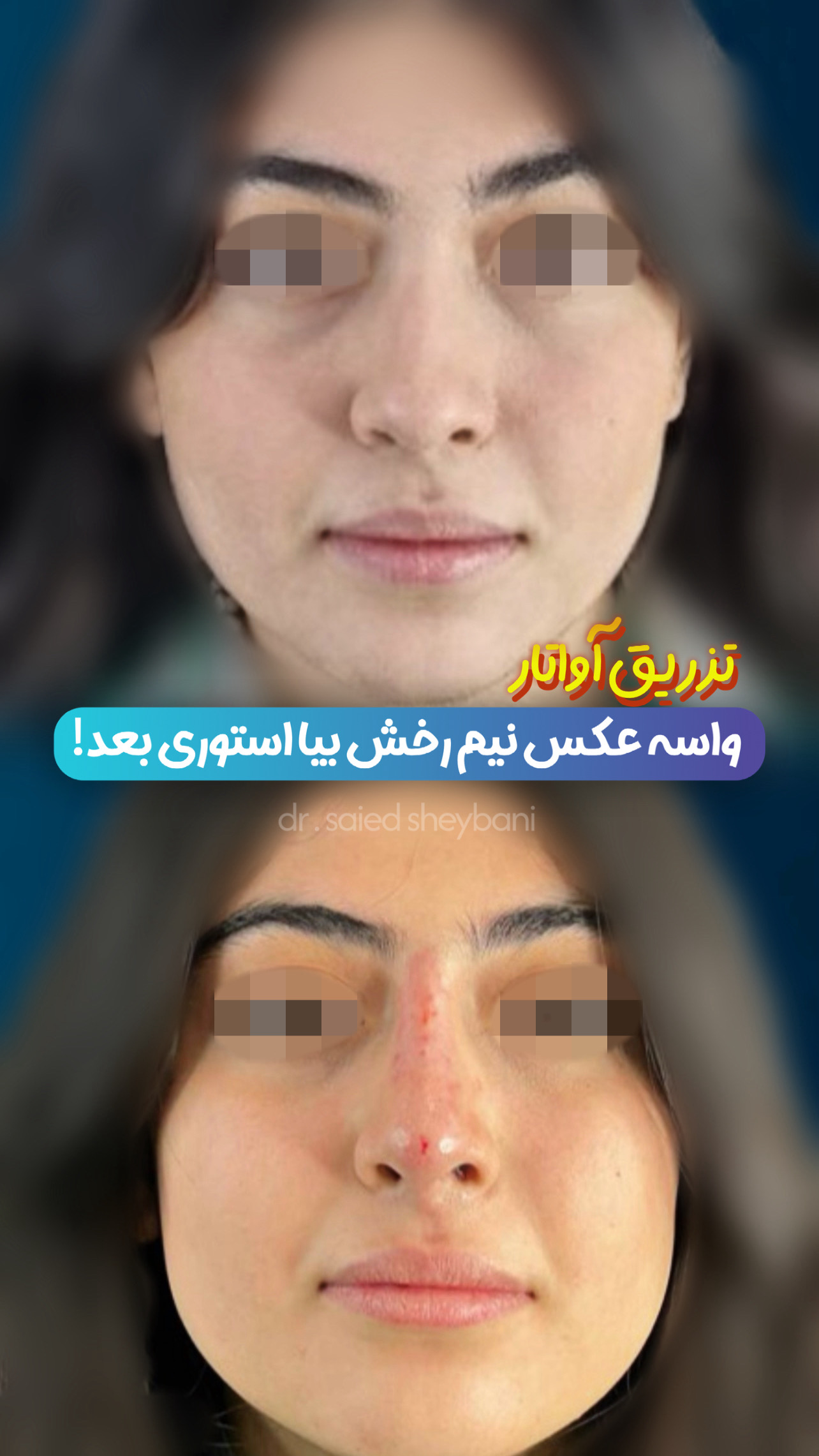 گالری آواتار بینی - تصویر 23