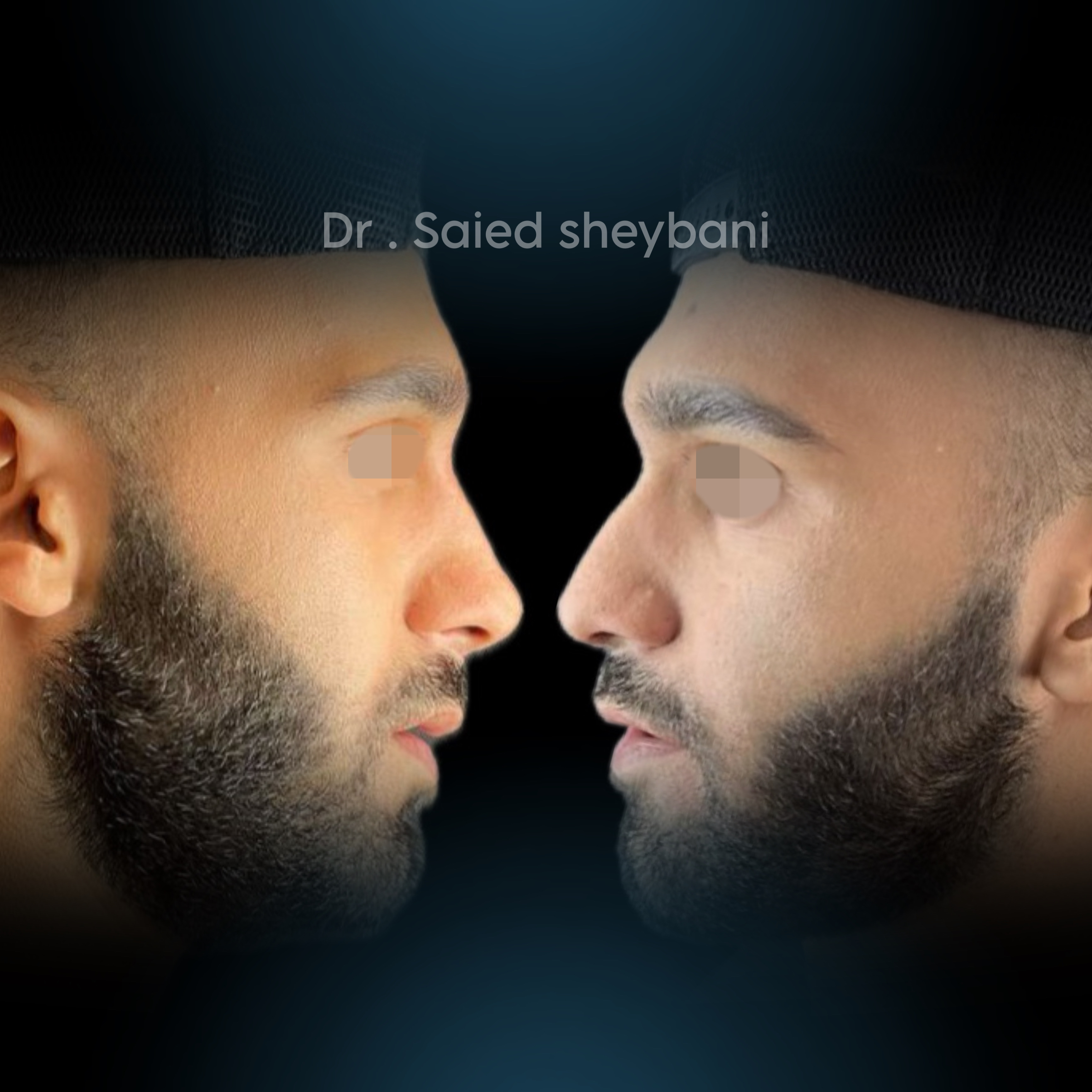 گالری آواتار بینی - تصویر 3