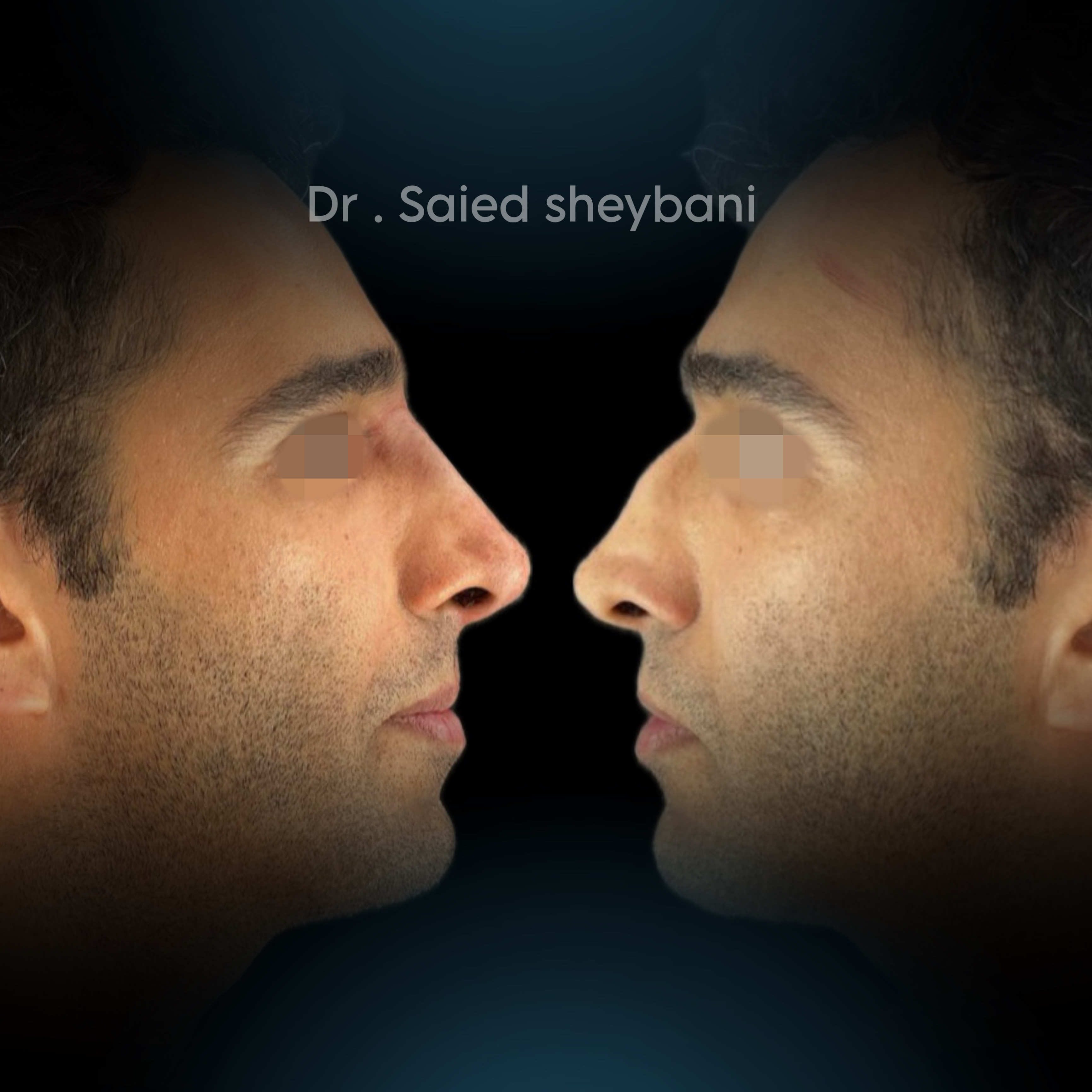 گالری آواتار بینی - تصویر 4