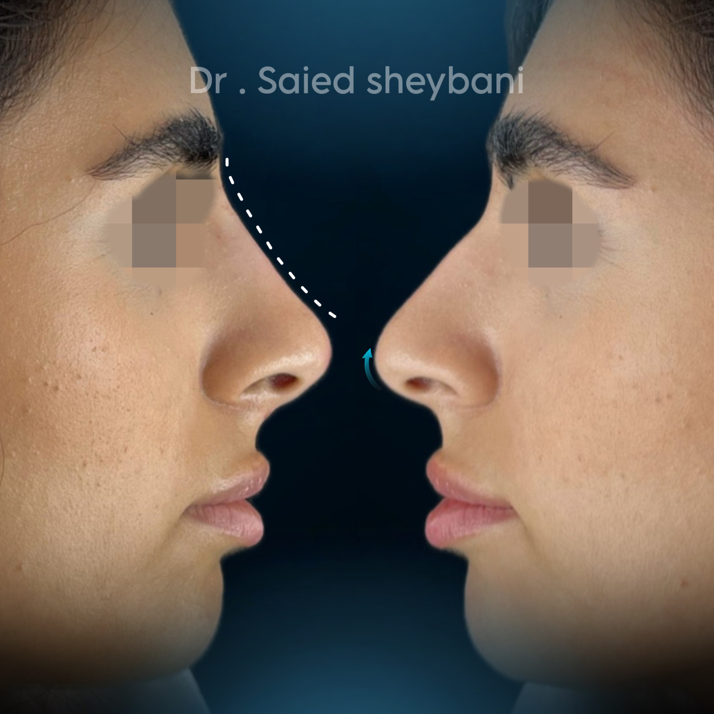 گالری آواتار بینی - تصویر 6