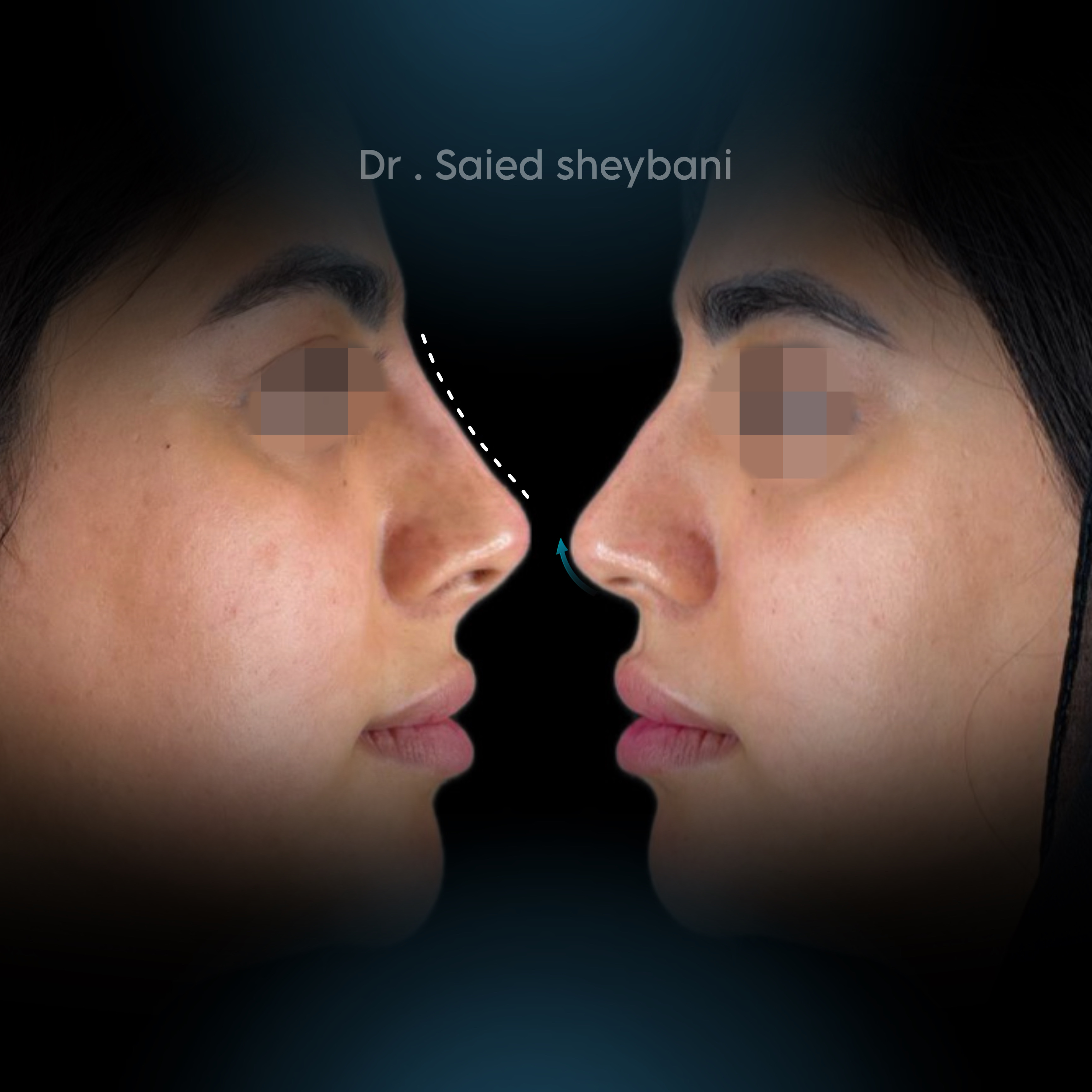 گالری آواتار بینی - تصویر 9