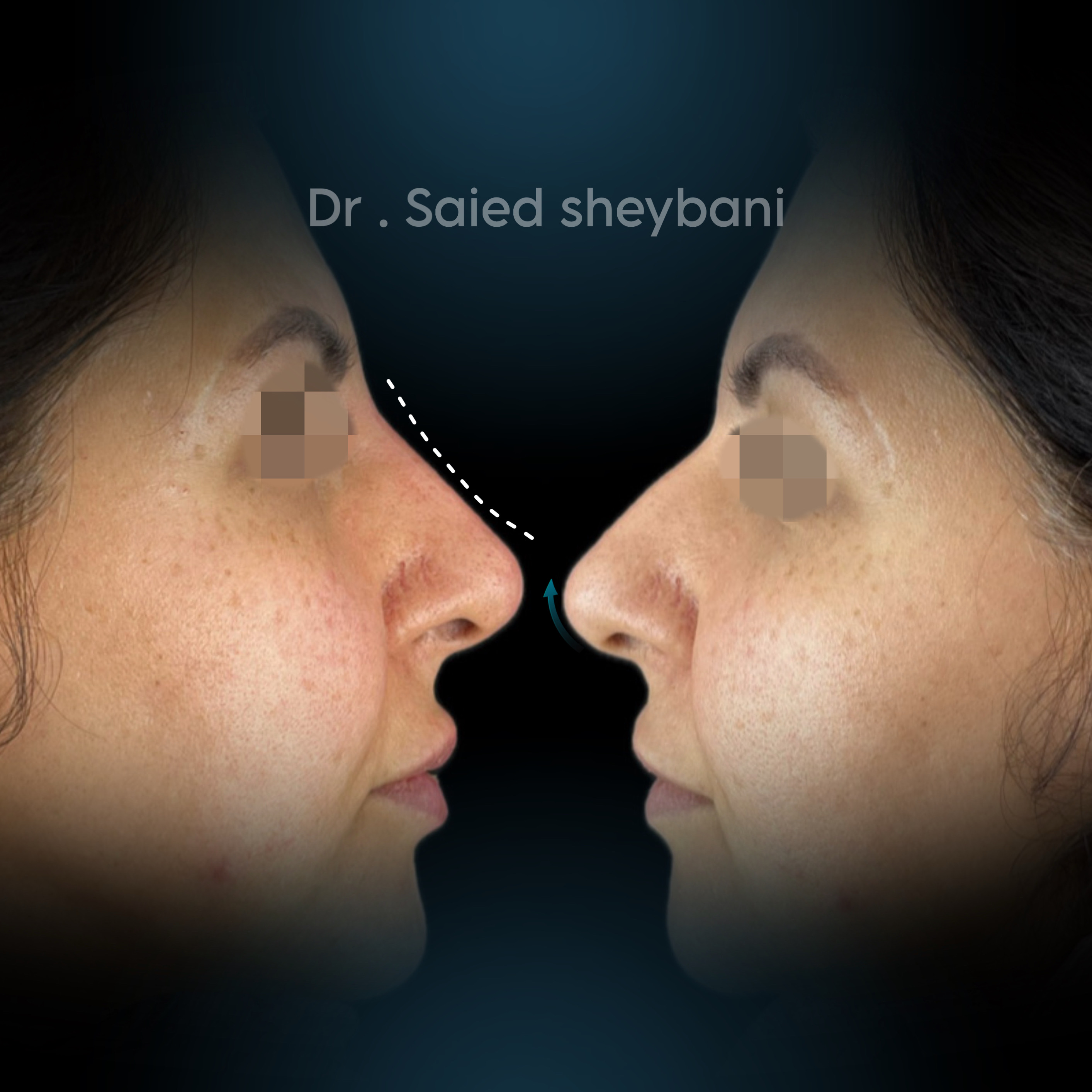 گالری آواتار بینی - تصویر 10