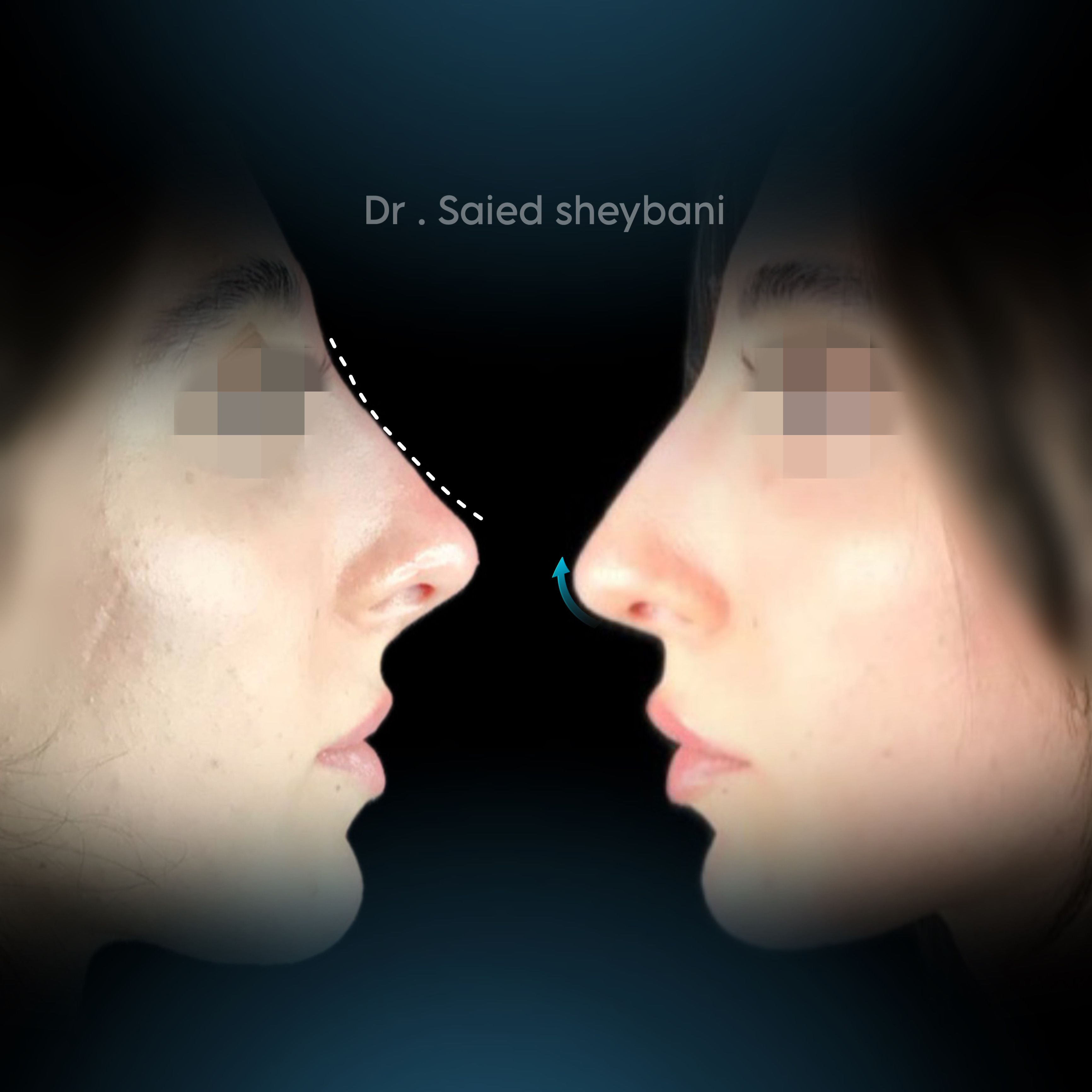 گالری آواتار بینی - تصویر 1