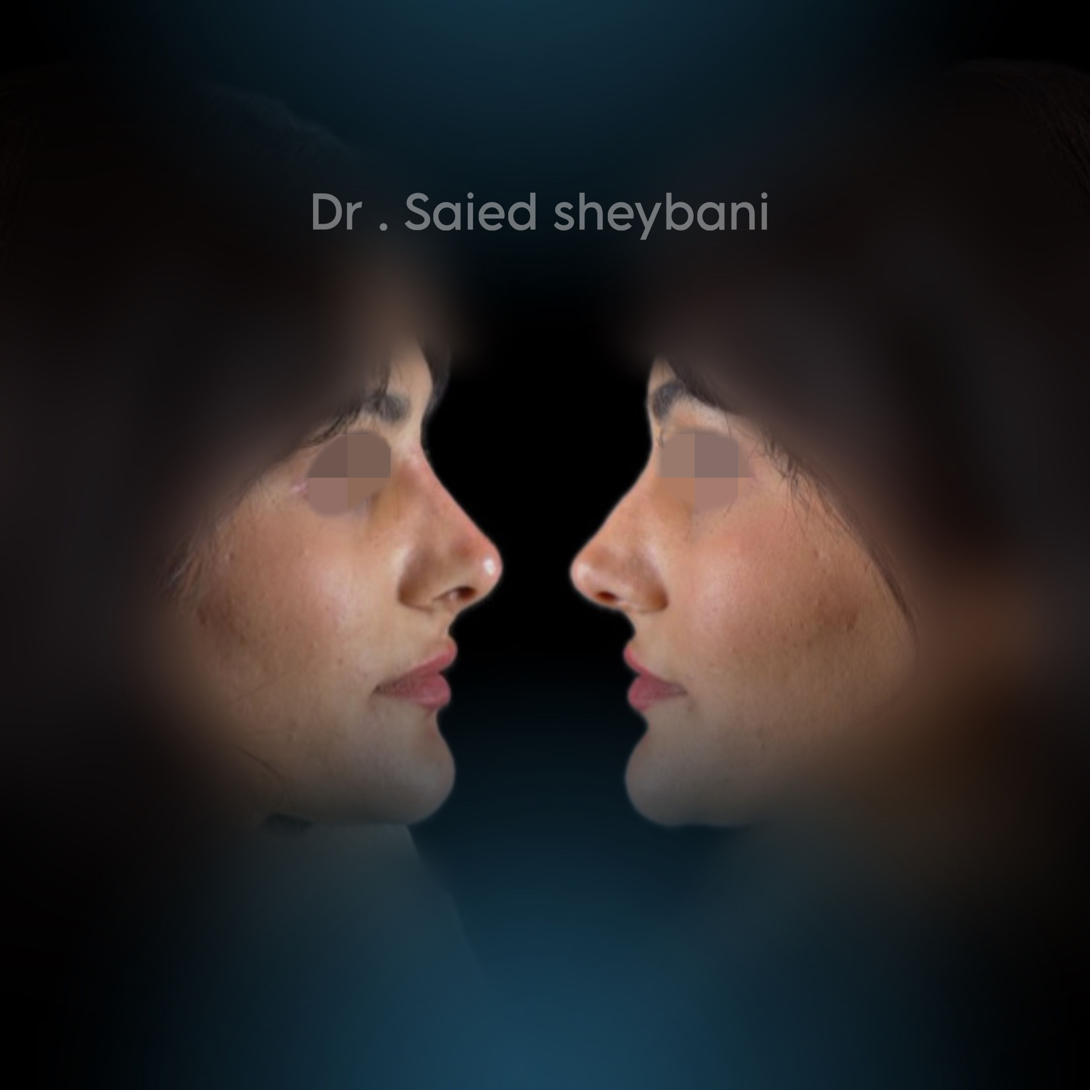 گالری آواتار بینی - تصویر 3