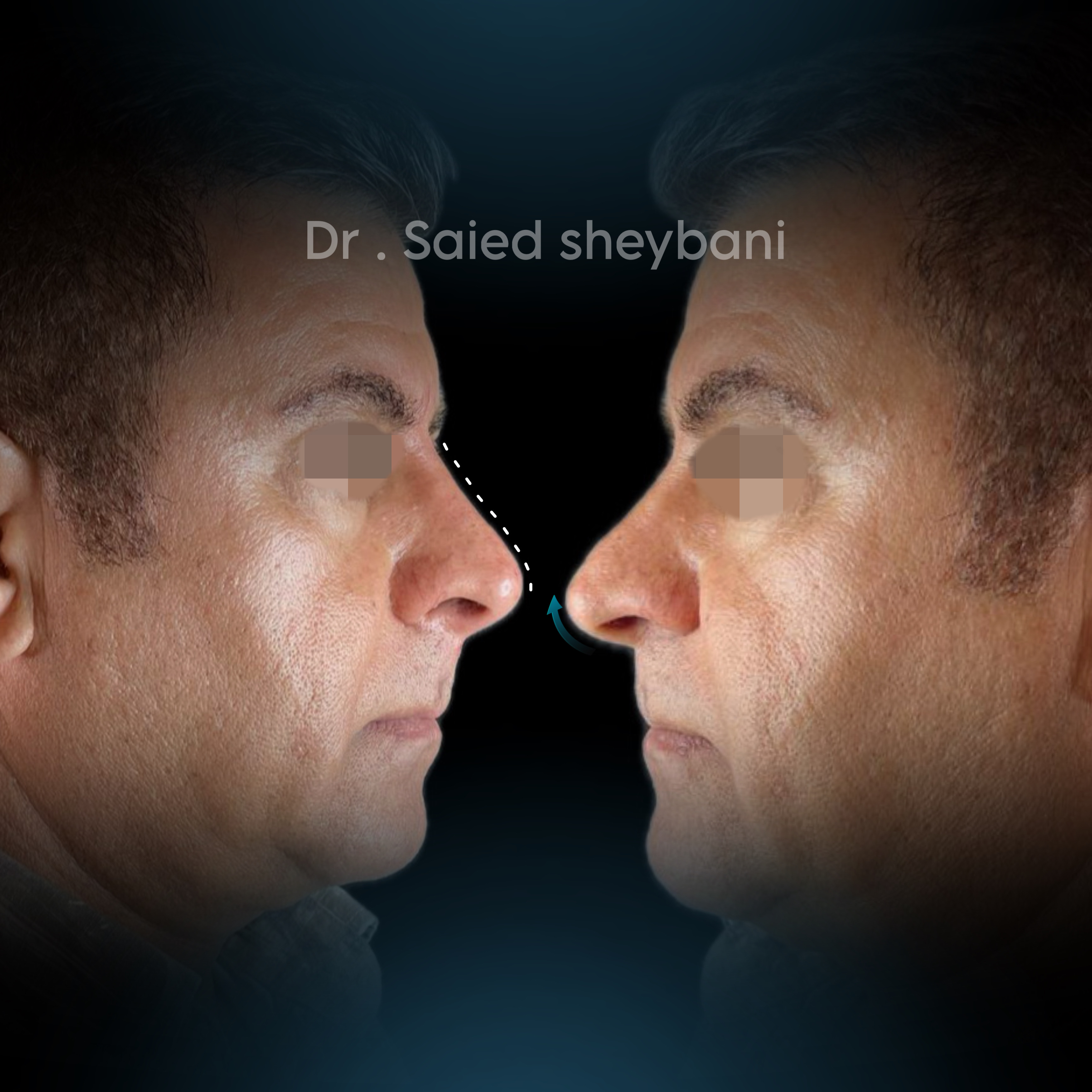 گالری آواتار بینی - تصویر 4