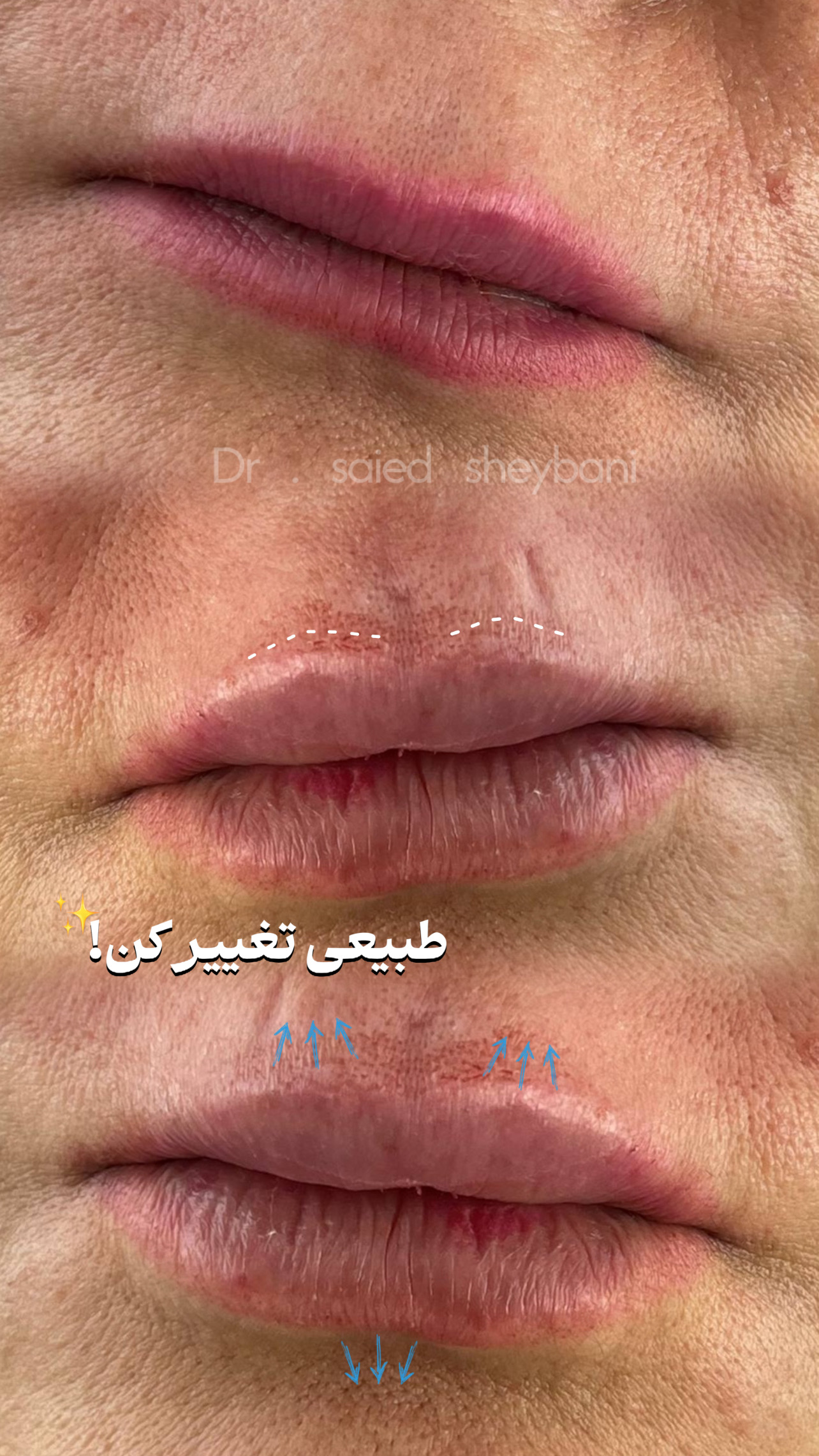 گالری Lattes Lip - تصویر 3